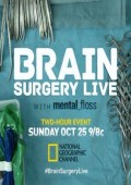 Operacja na mózgu